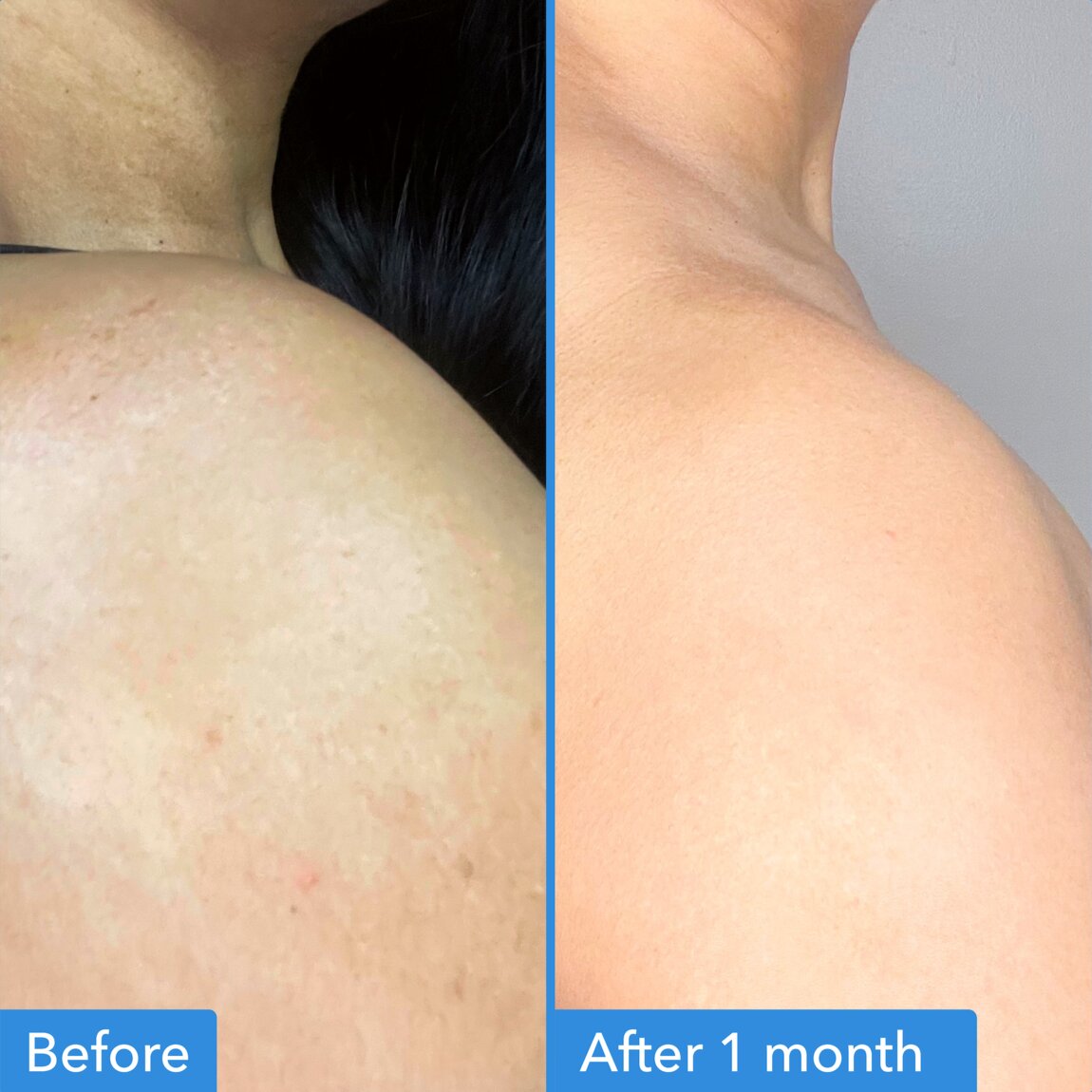 discoloration-correcting-body-treatment-r5 zb_p.jpg