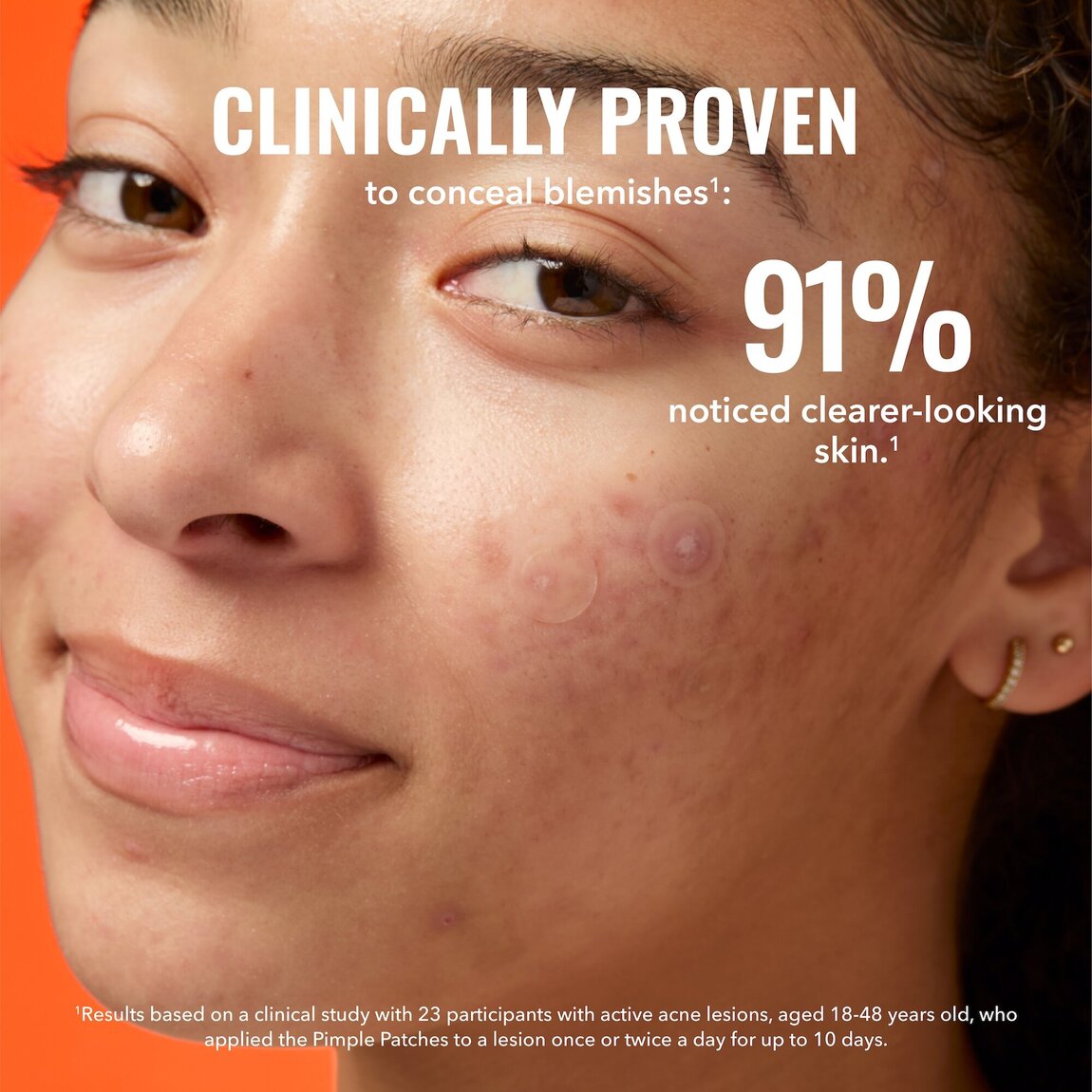 pimple-patches-q2 zb_p.jpg