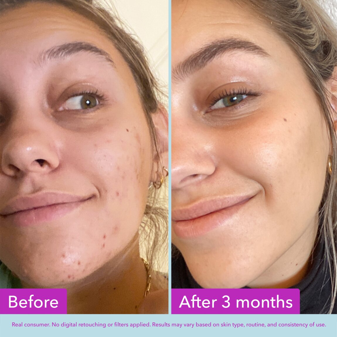 niacinamide-brightening-toner-j0 zb_p.jpg