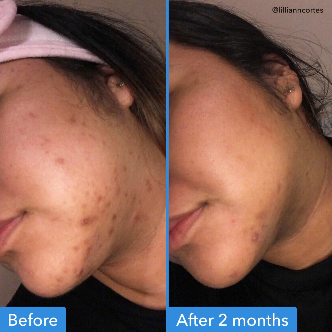 discoloration-correcting-serum-g3 zb_p.jpg